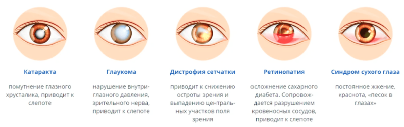 Стволовые клетки в лечении заболеваний глаз: перспективы и риски